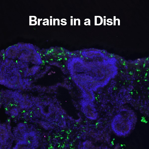 Brains in a dish